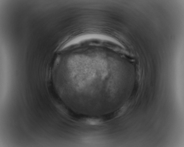 X0000086800168200705041615