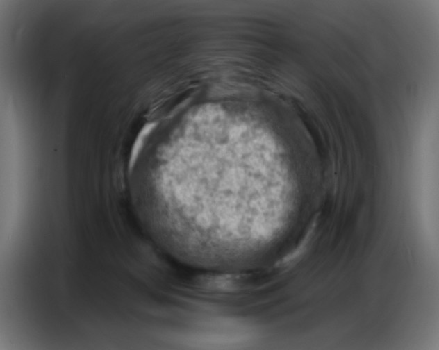 X0000086800182200705041615