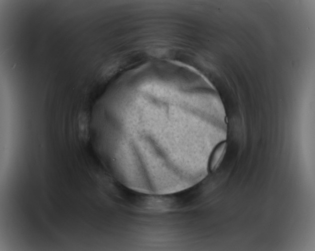 X0000086800234200705041614