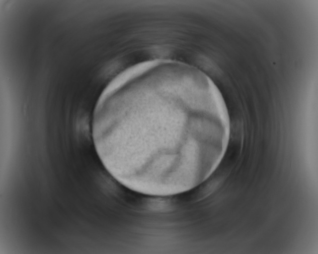 X0000086800238200705041614