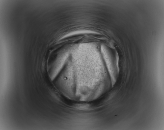 X0000086800266200705041614