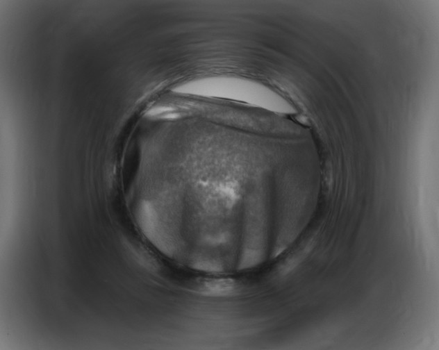 X0000086800355200705041613