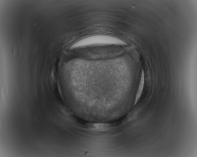 X0000086800371200705041613