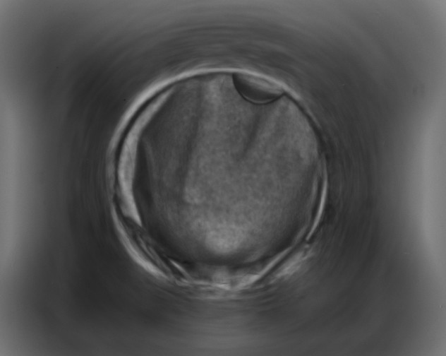 X0000086801519200705041558