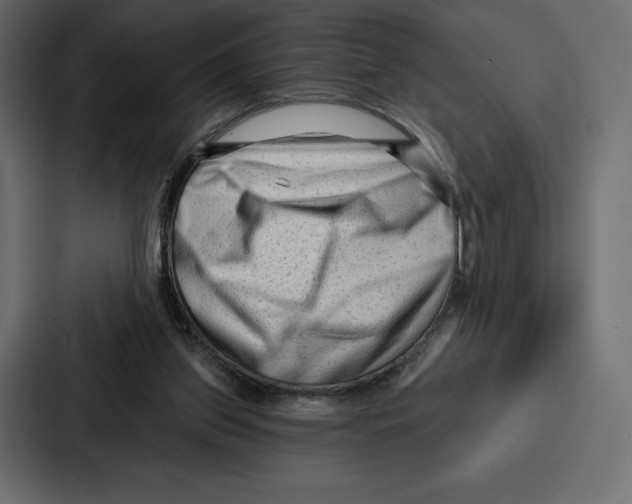 X0000086800157200705111842