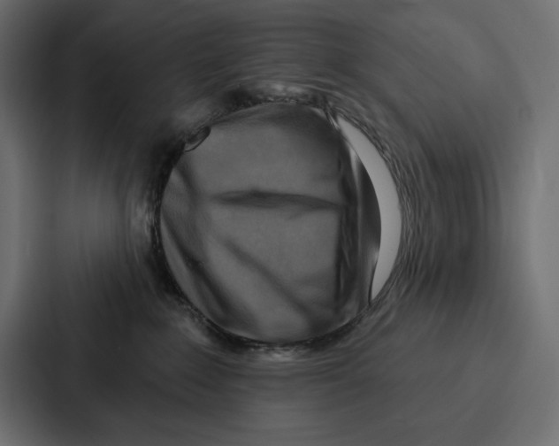 X0000086800235200705111841