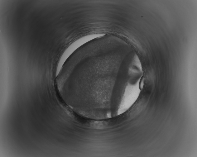 X0000086800277200705111841