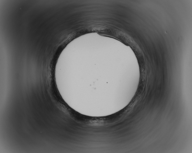X0000086800362200705111840