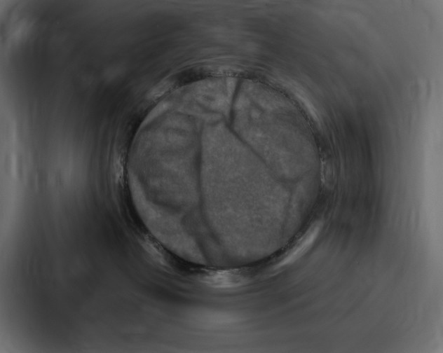 X0000086800382200705111840