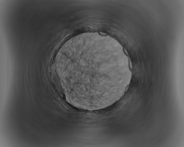 X0000086801009200705111831