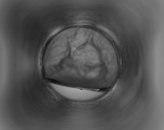 X0000086801405200705111826