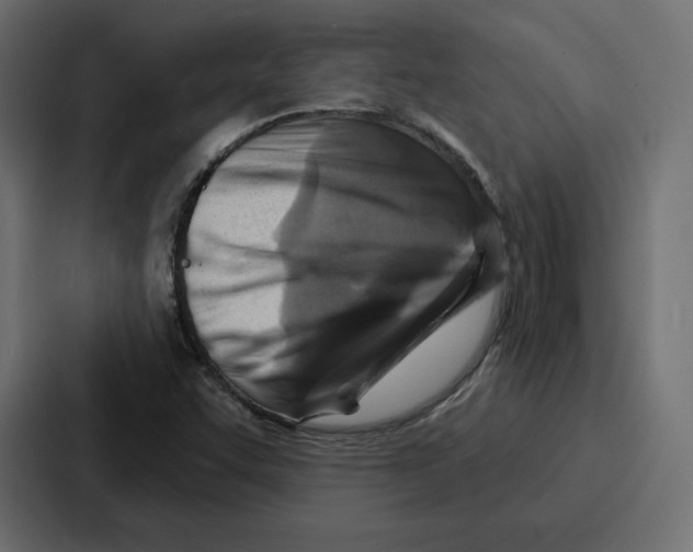 X0000086801455200705111825