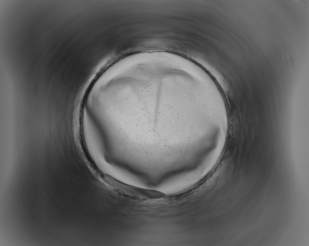 X0000086801477200705111825