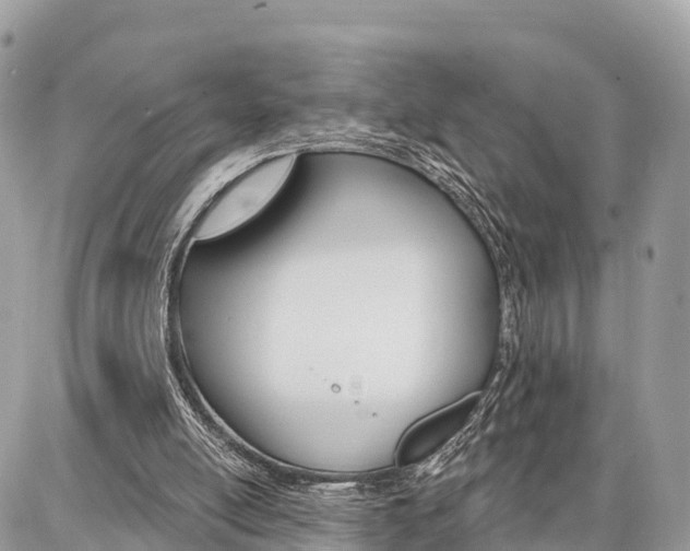 X0000086880054200704160950