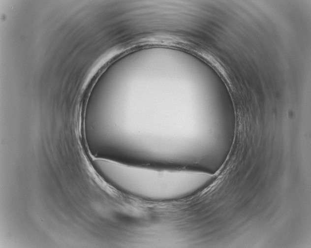 X0000086881131200704160933