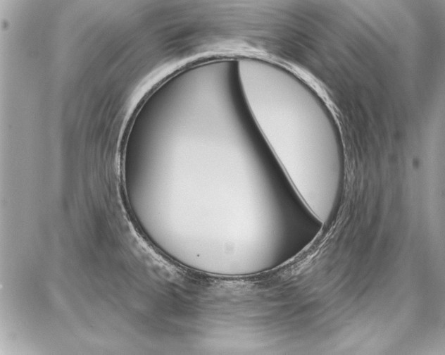 X0000086881335200704160930