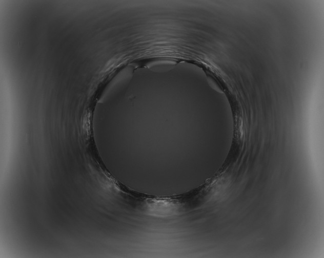 X0000086880475200704161225