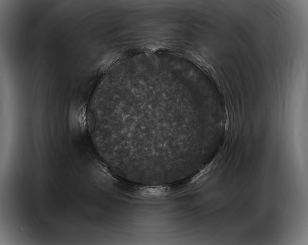 X0000086880479200704161225