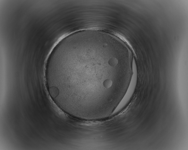 X0000086881091200704161215