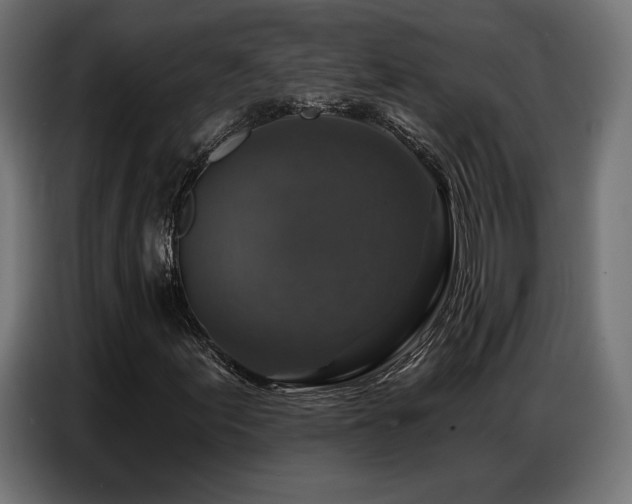 X0000086881155200704161214