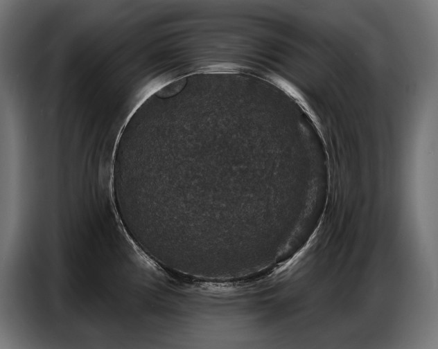 X0000086881194200704161214