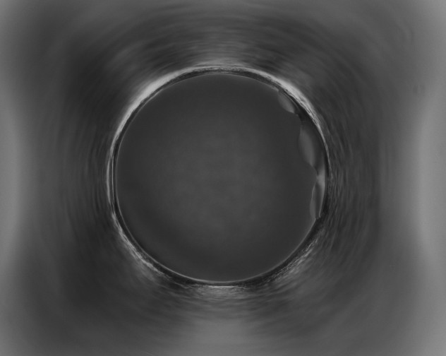 X0000086881295200704161212