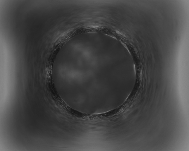 X0000086881397200704161210