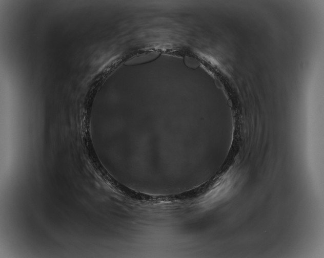 X0000086881399200704161210