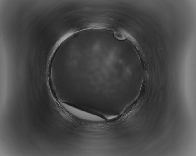 X0000086881427200704161211