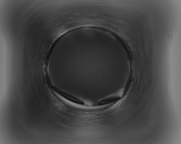 X0000086881497200704161209