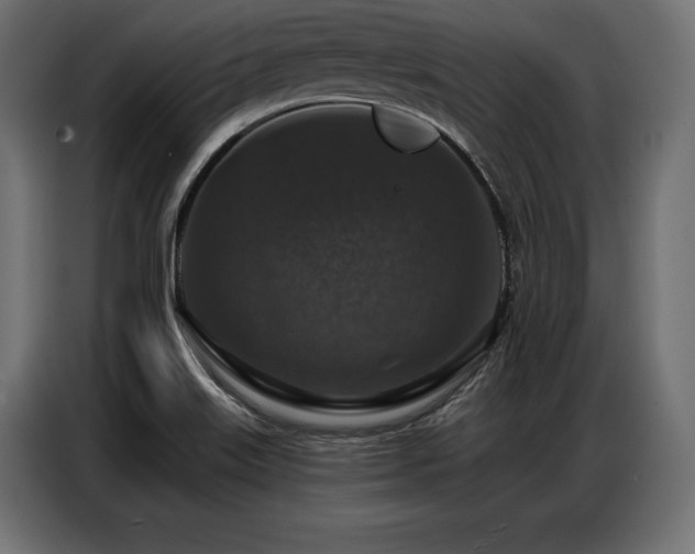 X0000086881515200704161209