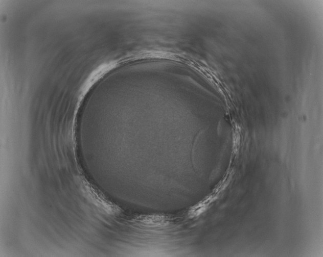 X0000086880104200704231113