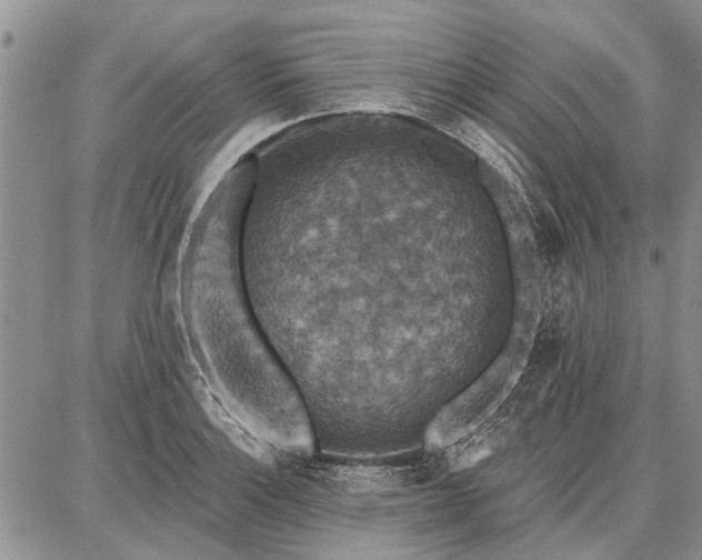 X0000086881132200704231056