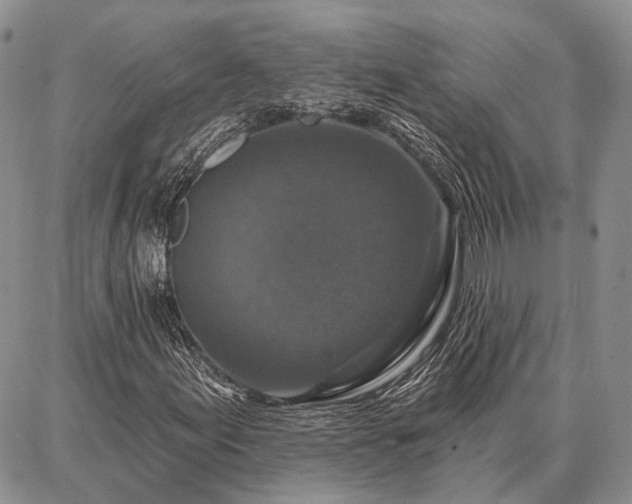 X0000086881155200704231056