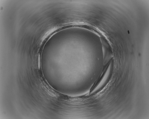 X0000086881171200704231055