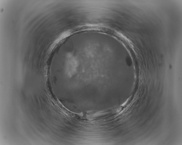 X0000086881411200704231051