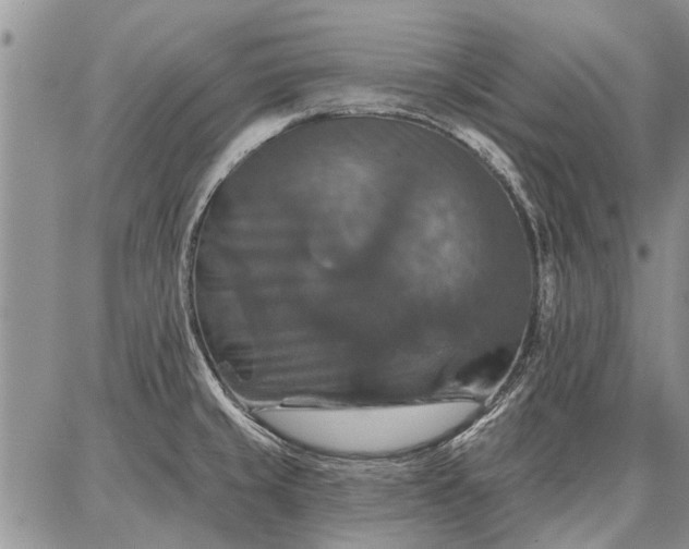 X0000086881429200704231052