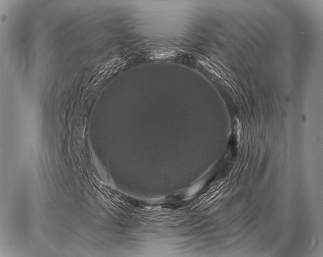 X0000086881441200704231051