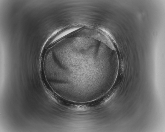 X0000086880395200704300941