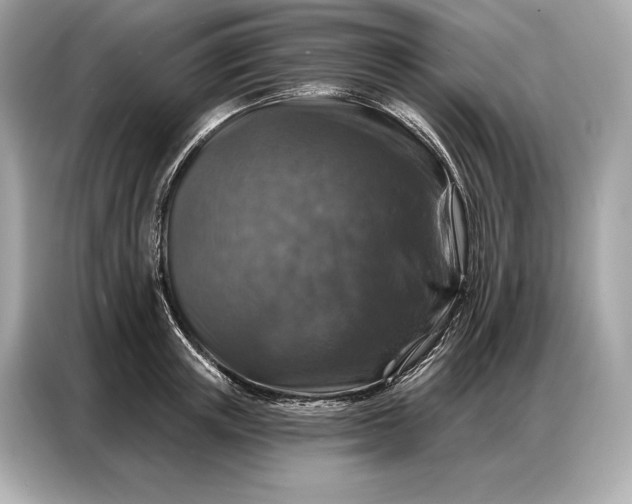 X0000086880851200704300935