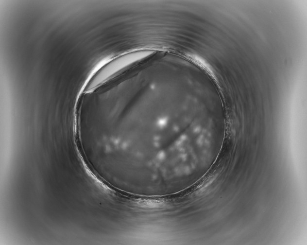 X0000086881095200704300932