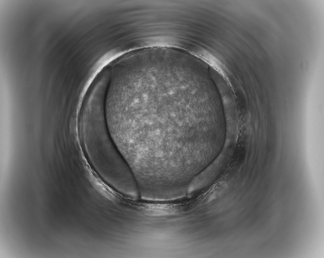 X0000086881132200704300931