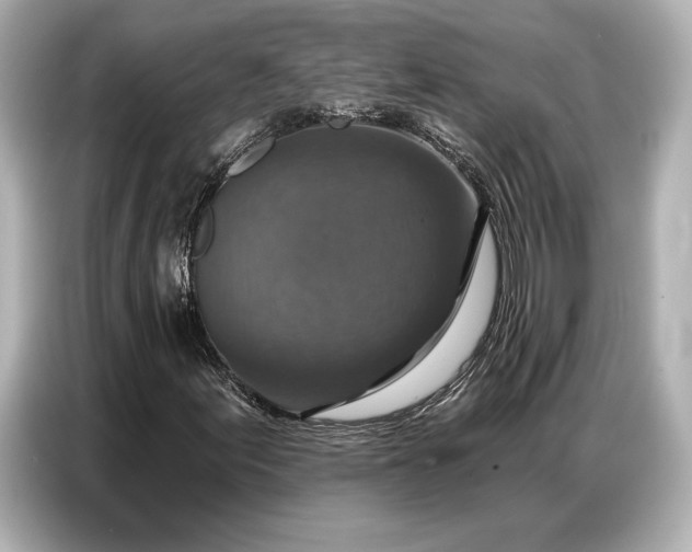 X0000086881155200704300931