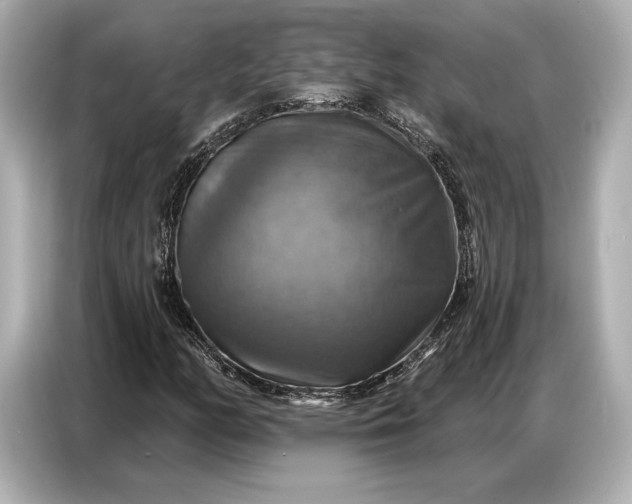 X0000086881158200704300931