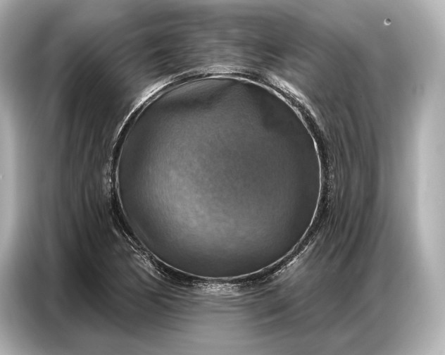 X0000086881170200704300931