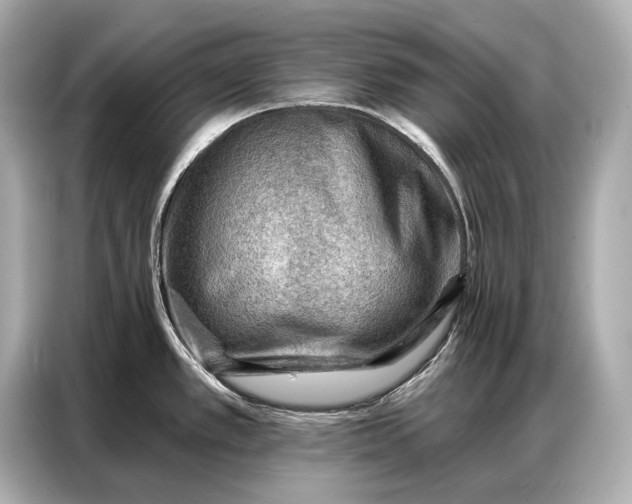 X0000086881389200704300928