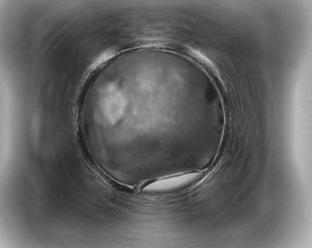 X0000086881411200704300928