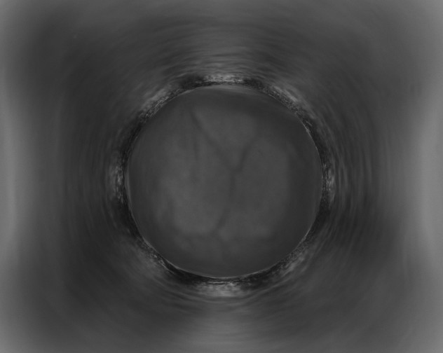 X0000086880322200705071207