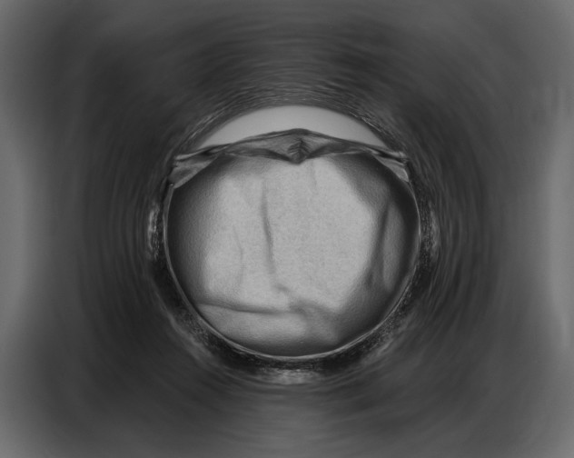 X0000086880360200705071207