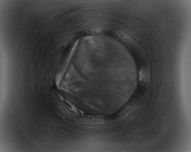 X0000086881011200705071157